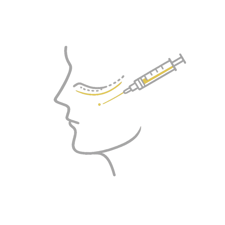 Augenringe Unterpritzung: Tränenrinne