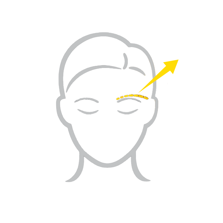 Gesichsausdruck & Blick nach der OP sind ein vollkommen neues Wirken, jedoch bekannt