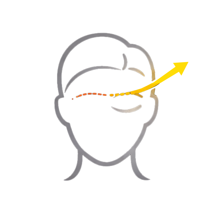 Ein echter Rams zeigt sich u.a. darin, dass die Narbenführung unsichtbar ist