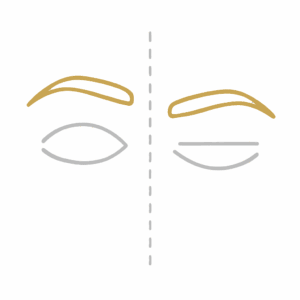 Bei asymmetrischen Augenbrauen