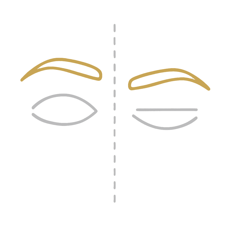 Bei asymmetrischen Augenbrauen