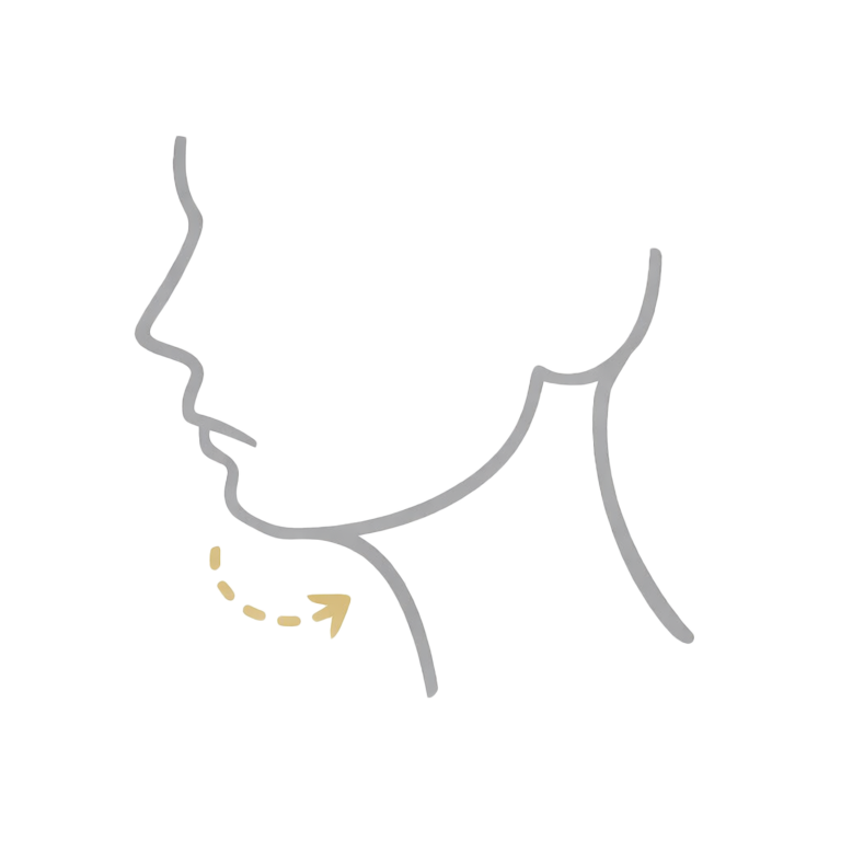 bei fliehendem oder schwachem Kinn